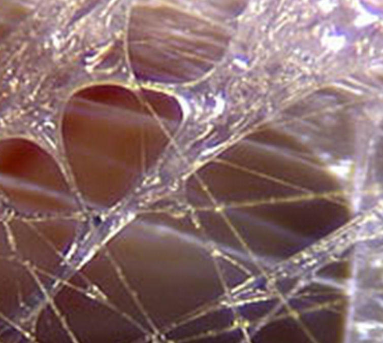 THE EMOTIONAL & ENERGETIC WEB: UNDERSTANDING FASCIA THE EMOTIONAL & ENERGETIC WEB: UNDERSTANDING FASCIA